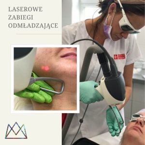 Laserowe odmładzanie twarzy Zielona Góra